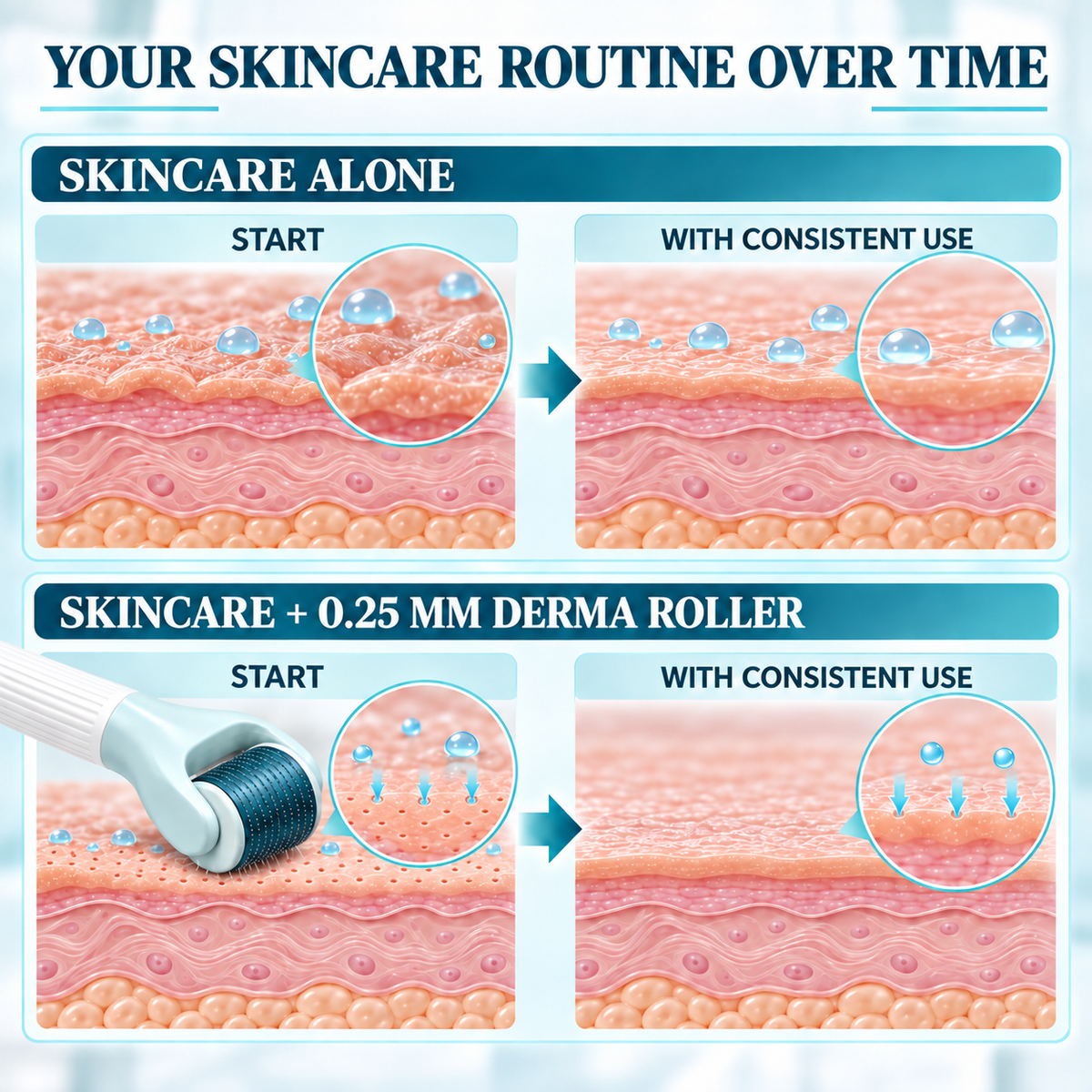 How 0.25 mm microneedling creates temporary surface microchannels